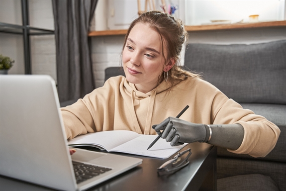Woman with prosthesis arm writing at notebook Woman with prosthesis arm writing at notebook